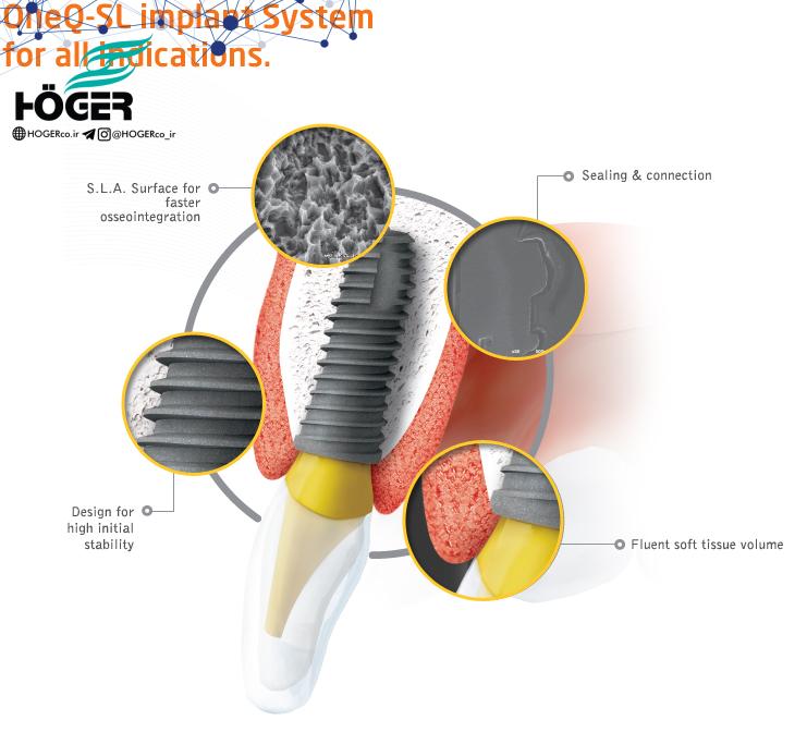 Dental equipment