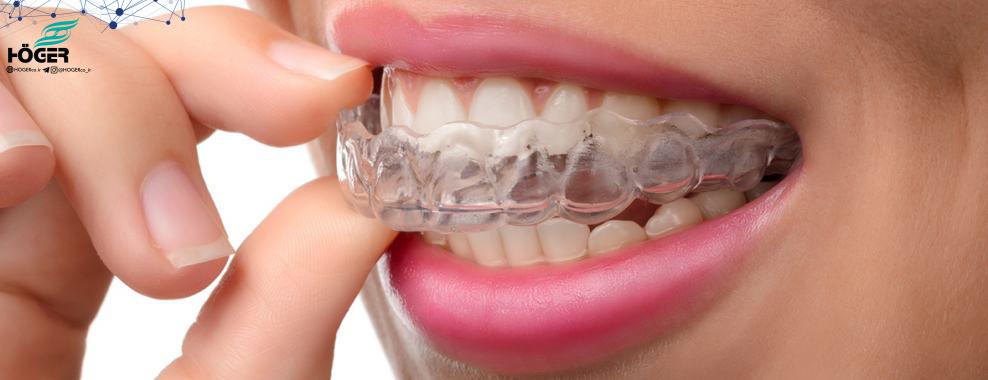 تولید نوعی پوشش ضد پوسیدگی برای دندان 16 Dental equipment
