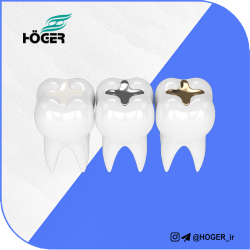 اجزای تشکیل دهنده آمالگام دندانی 10 اجزای تشکیل دهنده آمالگام دندانی