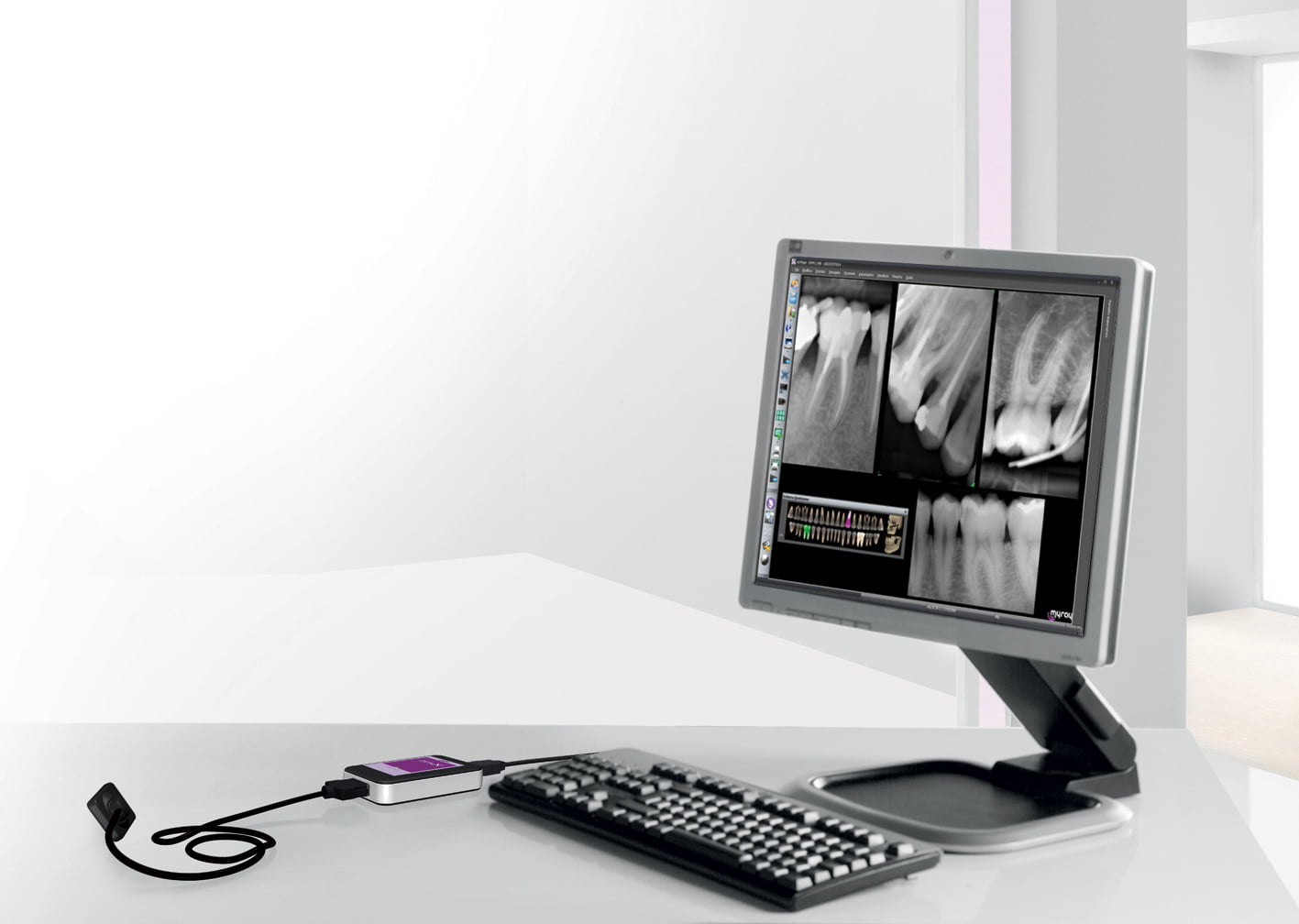 Myray Rvg Sensor هوگر سنسور ( RVG ) دندانپزشکی