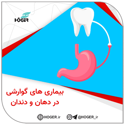 بیماری های گوارشی در دهان و دندان 18 بیماری های گوارشی