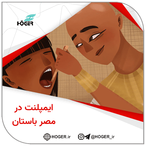 ایمپلنت در مصر باستان 6 ایمپلنت در مصر باستان