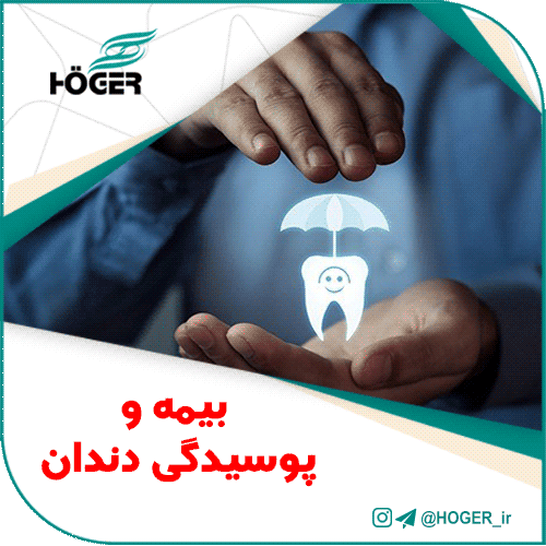 بیمه و پوسیدگی دندان‌
