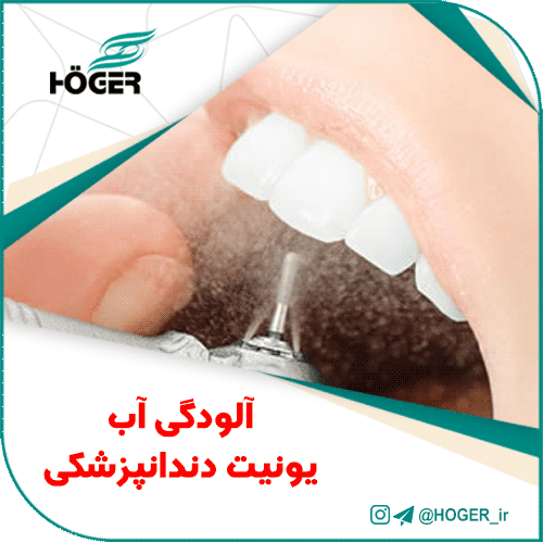 آلودگی آب یونیت دندانپزشکی