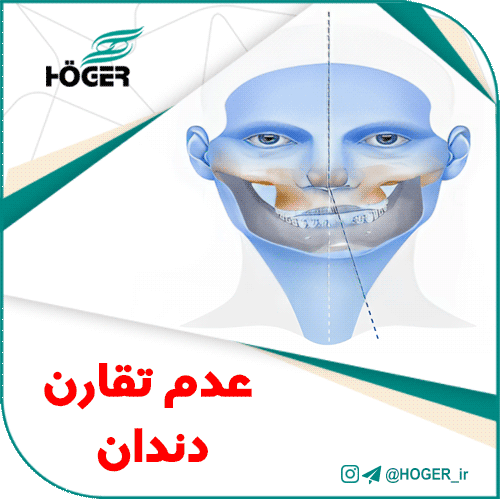 عدم تقارن دندان