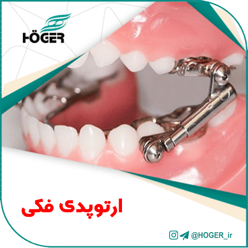 ارتوپدی فکی