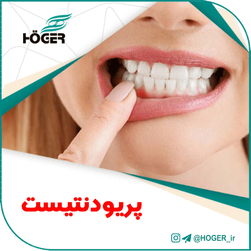 پریودنتیست