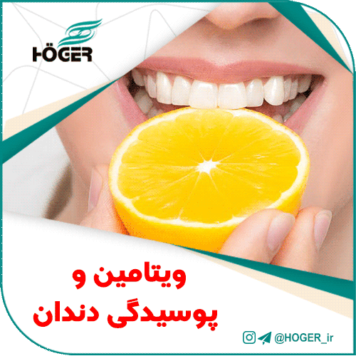 ویتامین و پوسیدگی دندان