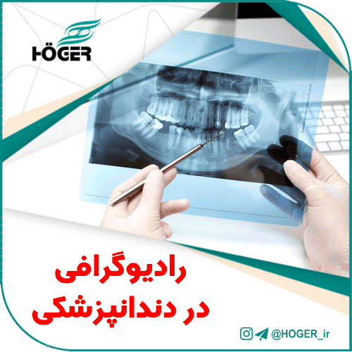 رادیوگرافی در دندانپزشکی