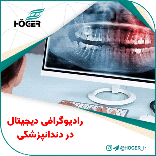 رادیوگرافی دیجیتال در دندانپزشکی