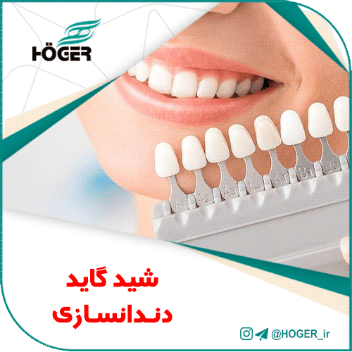 شید گاید دندانسازی