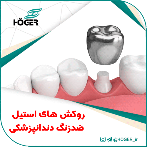 روکش های استیل ضدزنگ دندانپزشکی
