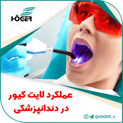 عملکرد لایت کیور در دندانپزشکی