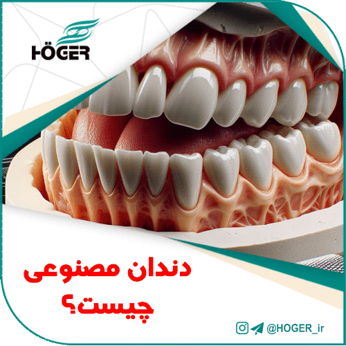 دندان مصنوعی