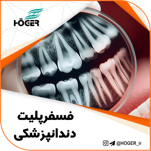 فسفرپلیت دندانپزشکی