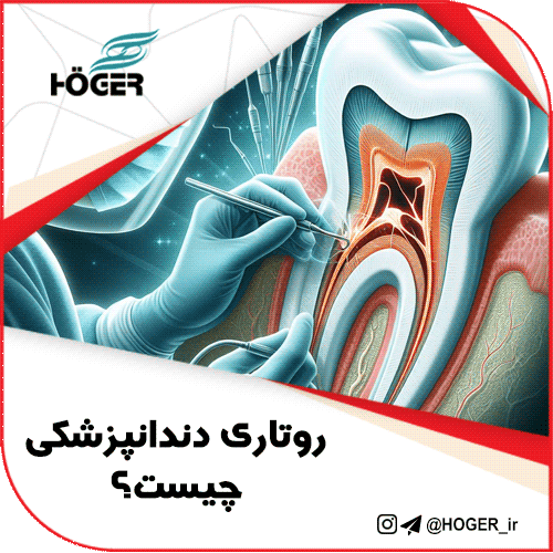 روتاری دندانپزشکی