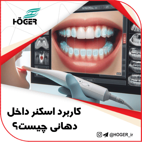 کاربرد اسکنر داخل دهانی چیست؟