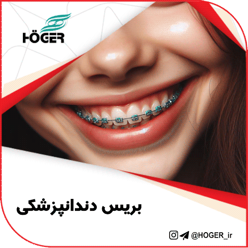بریس دندانپزشکی